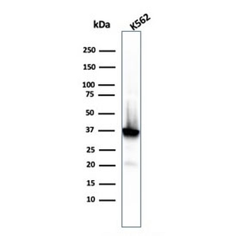 Recombinant Nucleophosmin Antibody / NPM1