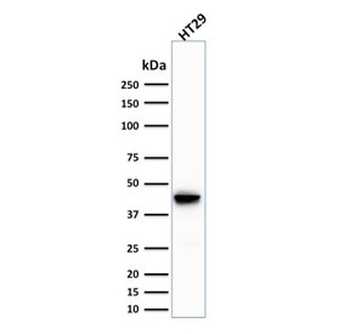 Cytokeratin 20 Antibody / CK20