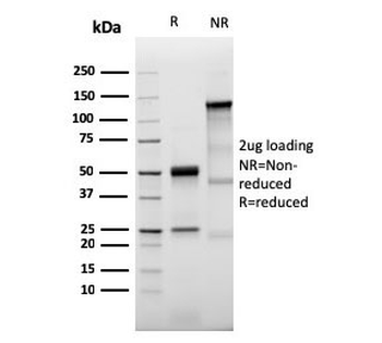 Recombinant Prolactin Receptor Antibody / PRLR