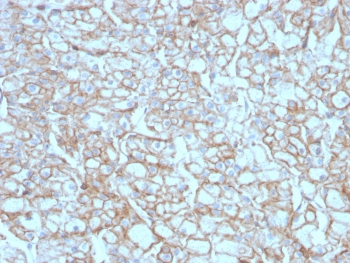 Recombinant PD-L1 Antibody / B7-H1 / CD274