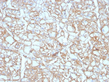 Recombinant PD-L1 Antibody / B7-H1 / CD274