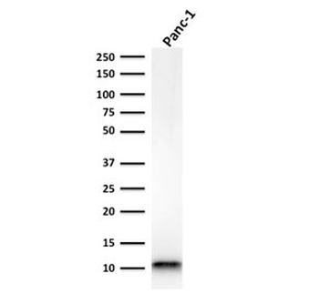 Recombinant FSP1 Antibody / S100A4