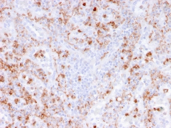 Recombinant S100A9 Antibody / MRP14 / Calgranulin B / Calprotectin