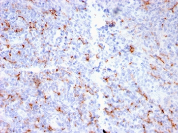 Recombinant S100A9 + Calprotectin Antibody