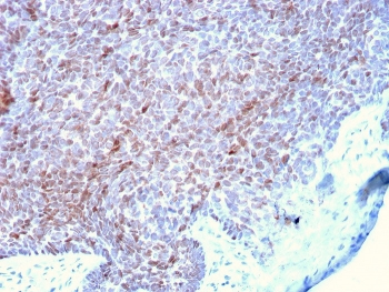 p73 Antibody