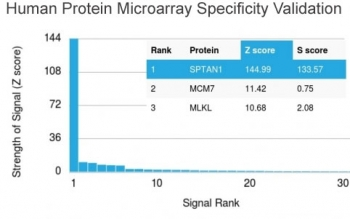 Alpha II Spectrin Antibody / Alpha Fodrin / SPTAN1 / NEAS