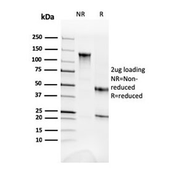 Alpha II Spectrin Antibody / Alpha Fodrin / SPTAN1 / NEAS