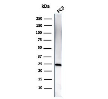 C1QA Antibody / Complement C1q A-Chain