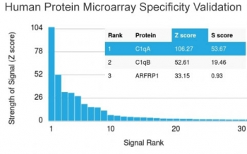 C1QA Antibody / Complement C1q A-Chain