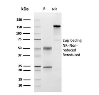 C1QA Antibody / Complement C1q A-Chain