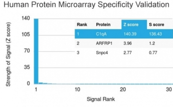 C1QA Antibody / Complement C1q A-Chain