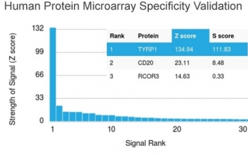 Tyrosinase-Related Protein-1 Antibody / TRP1 / TYRP1