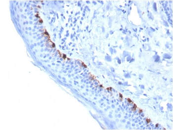 TRP1 / Tyrosinase-Related Protein-1 Antibody / TYRP1