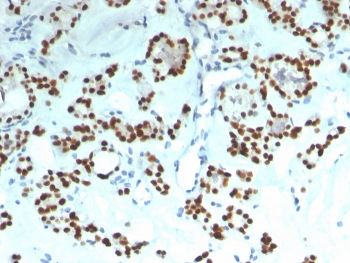 Recombinant PAX8 Antibody