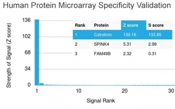 CALB2 Antibody / Calbindin 2 / Calretinin