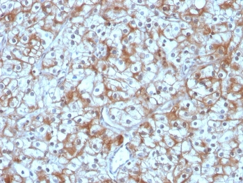 Calpastatin Antibody
