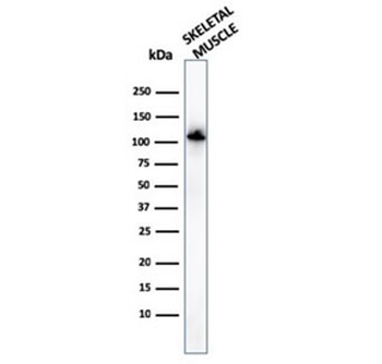 Actinin Alpha 2 Antibody / Sarcomeric Alpha Actinin / ACTN2