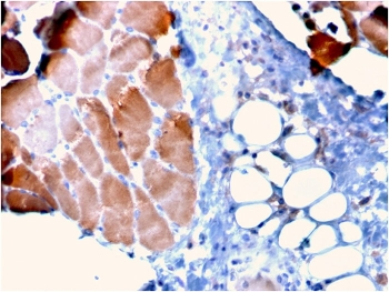 Actinin Alpha 2 Antibody / Sarcomeric Alpha Actinin / ACTN2