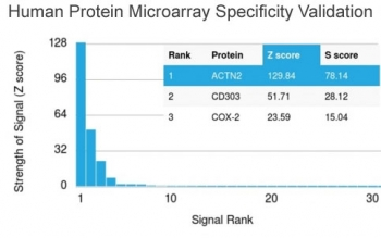 Actinin Alpha 2 Antibody / Sarcomeric Alpha Actinin / ACTN2
