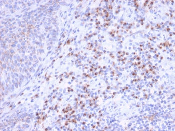 EBAG9 Antibody / Estrogen Receptor Binding Site Associated Antigen 9 / RCAS1