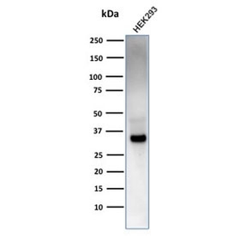 EBAG9 Antibody / Estrogen Receptor Binding Site Associated Antigen 9 / RCAS1
