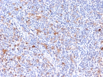 EBAG9 Antibody / Estrogen Receptor Binding Site Associated Antigen 9 / RCAS1