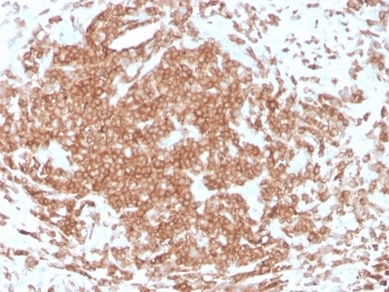 Recombinant CD3e Antibody