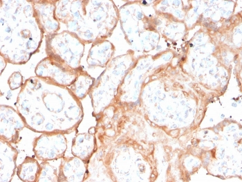 Recombinant Aurora B Antibody / AURKB