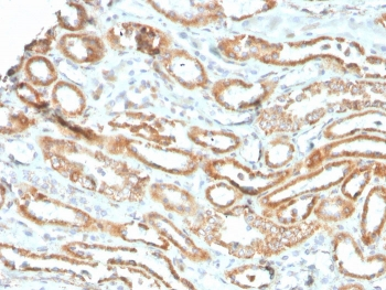 Recombinant Aurora B Antibody / AURKB