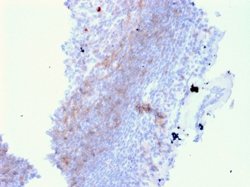 CD72 Antibody