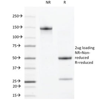 VEGFR2 Antibody / VEGF Receptor 2 / KDR