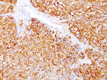 Melanoma Marker Antibody Cocktail (MART-1 & gp100)