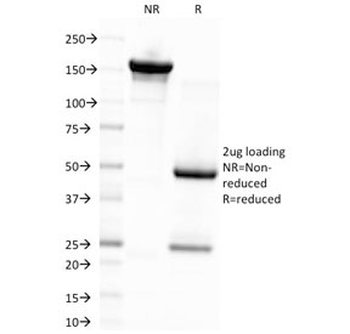 EBV Antibody / Epstein-Barr Virus / LMP-1