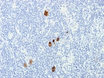 EBV Antibody Cocktail / Epstein-Barr Virus / LMP-1