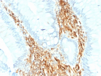 Recombinant Vimentin Antibody