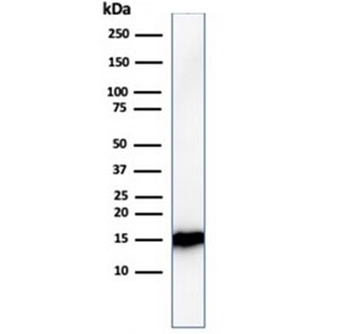 FABP1 Antibody