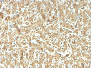 FABP1 Antibody