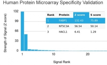 FABP1 Antibody