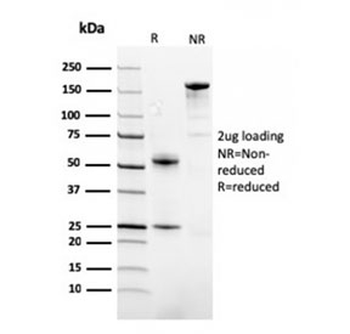 FABP1 Antibody