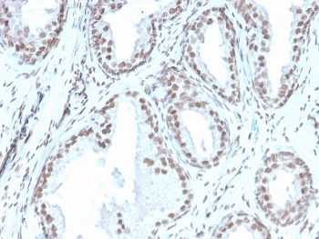 Recombinant ATRX Antibody