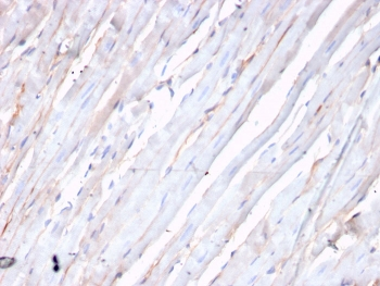 Recombinant CDH2 Antibody / N-Cadherin / CD325