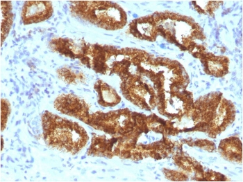 Recombinant AMACR Antibody