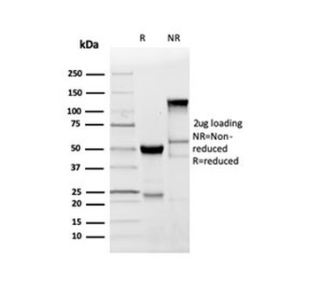 Recombinant Myelin Basic Protein Antibody