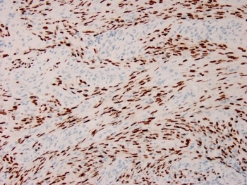 Recombinant HHV8 Antibody
