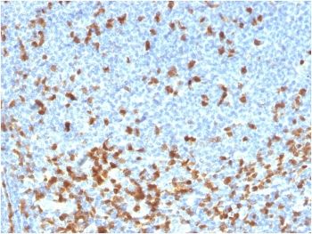 Recombinant ZAP70 Antibody