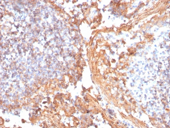 Recombinant Catenin beta Antibody