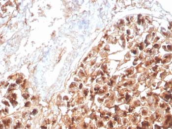 Recombinant Eosinophil Peroxidase Antibody