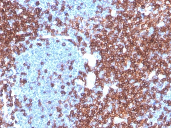 Recombinant CD4 Antibody