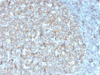 Recombinant CD81 Antibody