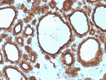 Thyroid Peroxidase Antibody / TPO